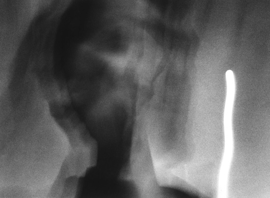 Didier De Nayer – Flou et usage de flou